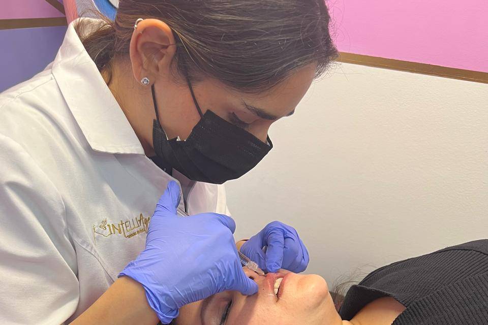 Filler en labios