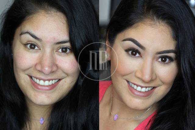 Contouring