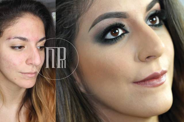 Corrección de imperfecciones