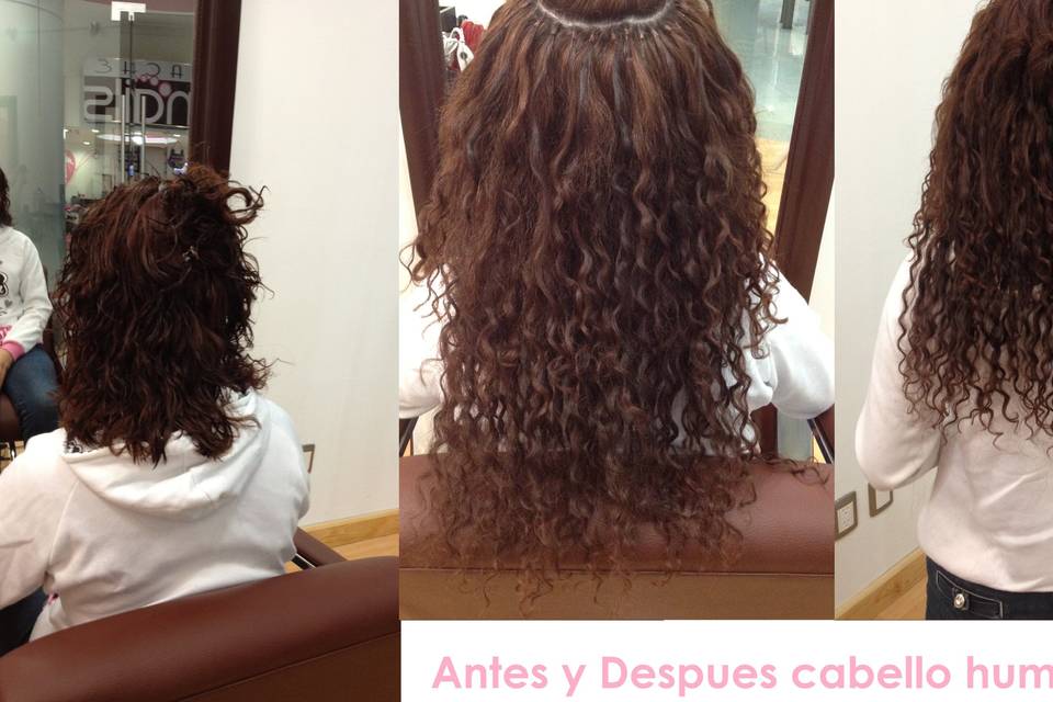 Extensiones