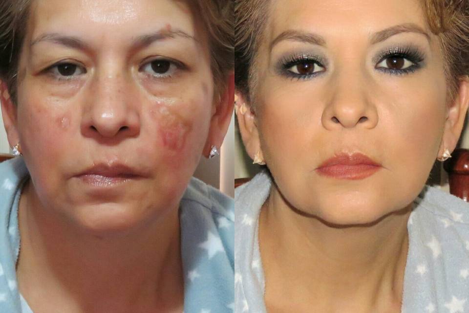 Maquillaje correctivo