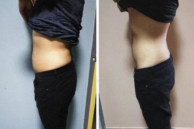 Antes y después
