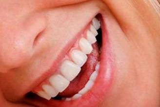 Blanqueamiento dental