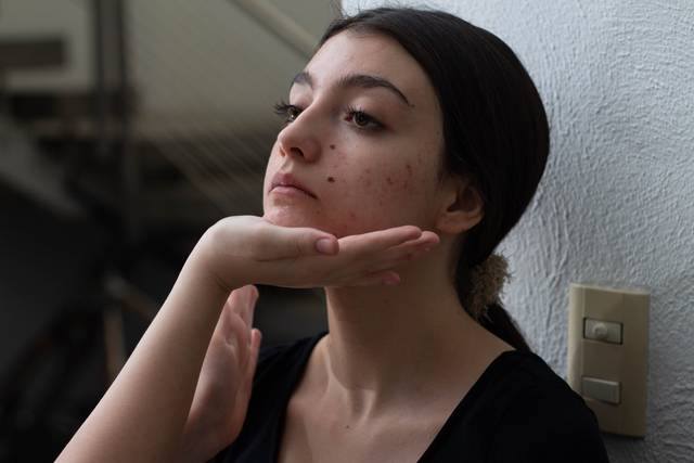 Skin care proceso